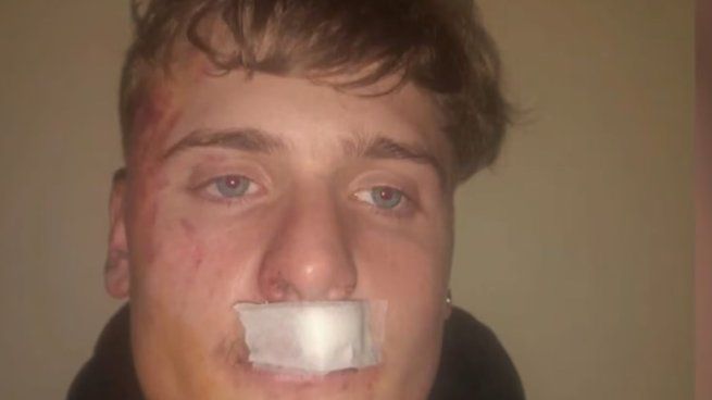 El joven de 19 años recibió una piña, cayó al suelo y continuaron agrediéndolo